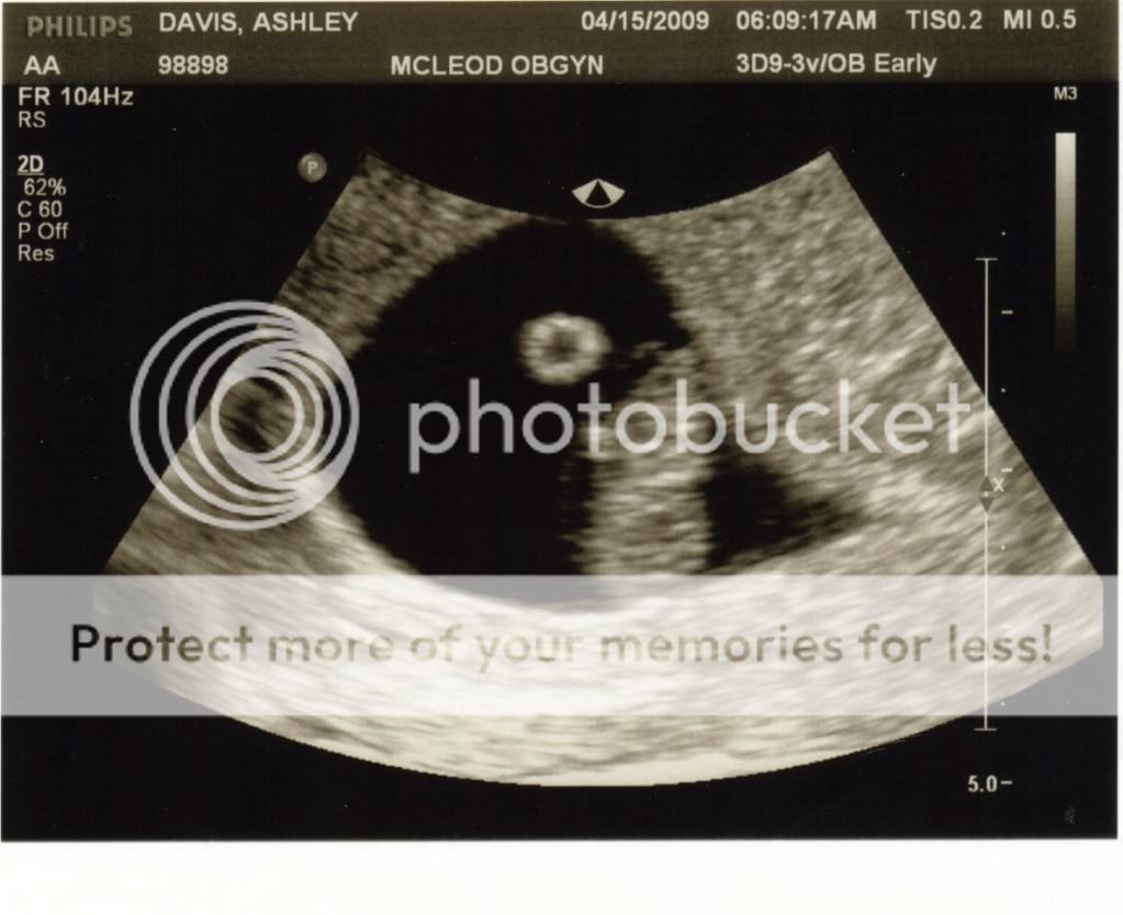 pregnancy dating scan what to expect