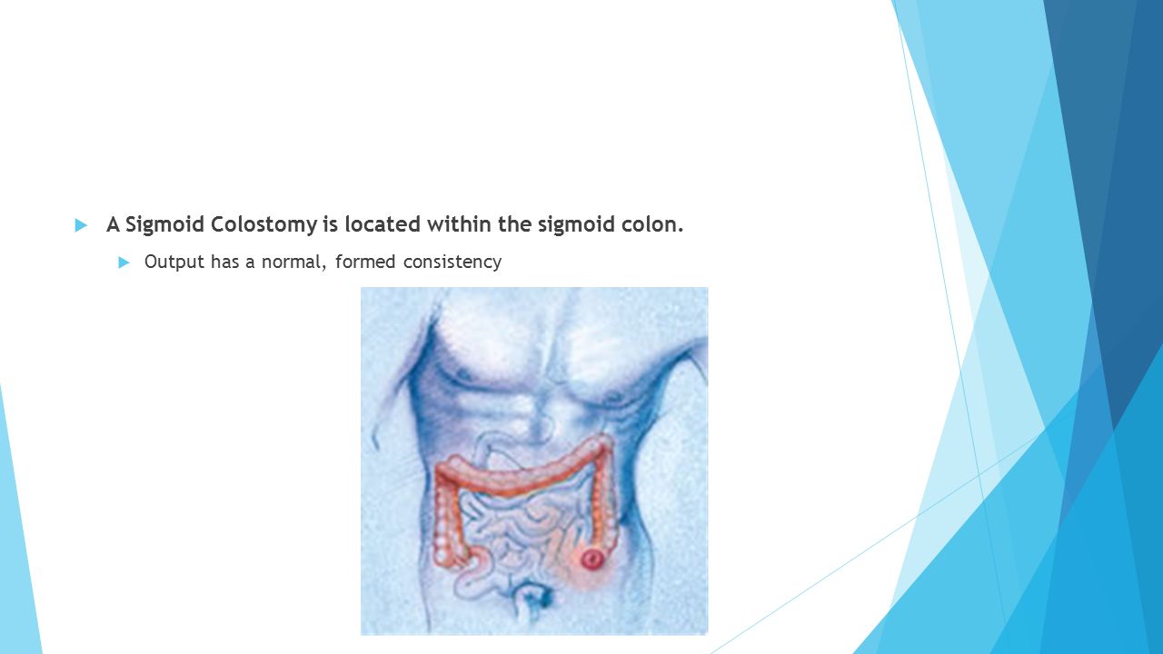 ostomy dating